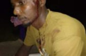 مجددًا.. اعتداءات عنيفة على اللاجئين السودانيين في أوغندا