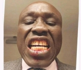 حادثة مؤسفة في سفارة جنوب السودان بأميركا..