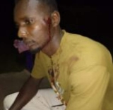 مجددًا.. اعتداءات عنيفة على اللاجئين السودانيين في أوغندا